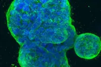Study points to new treatment approach for aggressive breast cancer