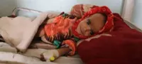 Funding cuts force closure of over 100 child malnutrition treatment sites in Afghanistan: UN official