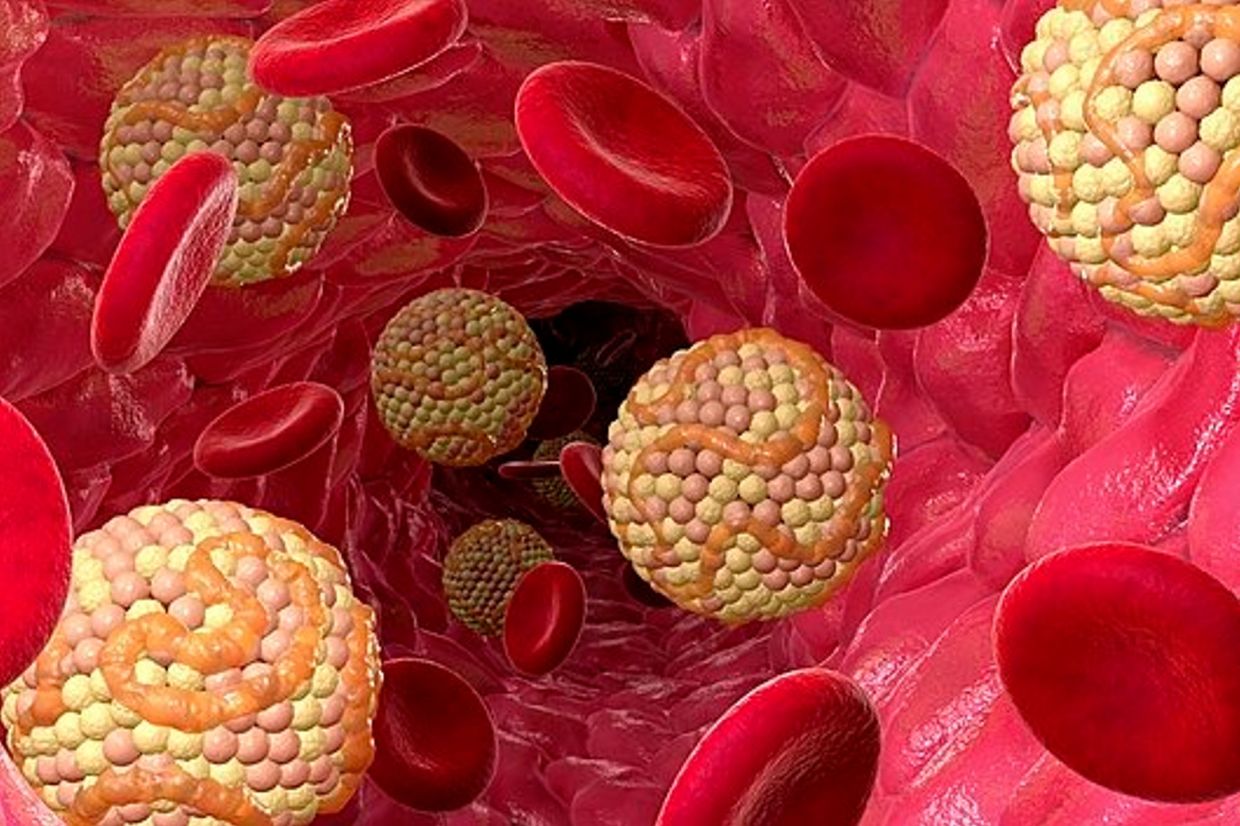 QuickCheck: Is it true that stress can raise your cholesterol levels?