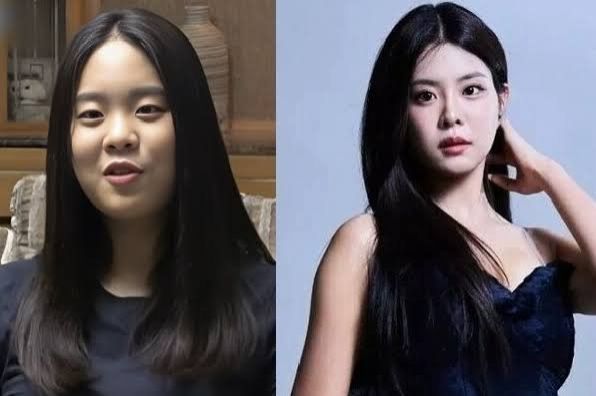 韩国小姐冠军因涉嫌整容而受到审查,引发了人们对韩国审美观的质疑——以及这种美是否天然是否重要。