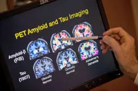 We can all lower our risk of developing dementia