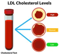 Lowering that ‘bad’ cholesterol to keep your heart healthy