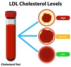 Lowering that ‘bad’ cholesterol to keep your heart healthy