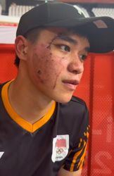 New Joe rides through fresh facial injury to finish seventh in omnium