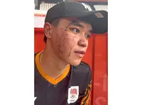 Six facial stitches could not keep New Joe off track
