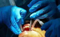 MDA calls for permanent post for contract dental officers