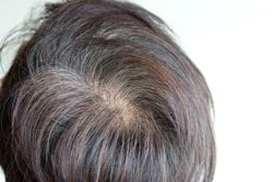 QuickCheck: Does plucking out a white hair cause more to grow in its place?