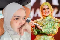 Siti Nurhaliza's facial bruises linger weeks after concert rehearsal fall