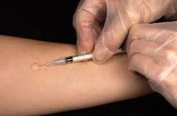 Parents demand answers after needle reused on 78 pupils in China